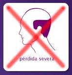 Perdida-severa Pérdida de pelo severa