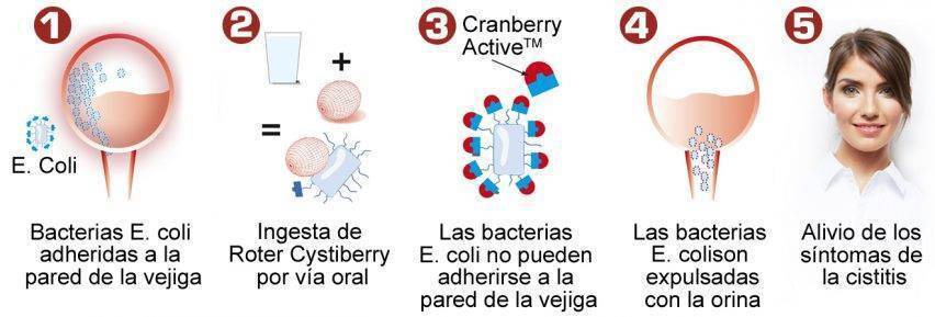 Roter Cystiberry para la cistitis