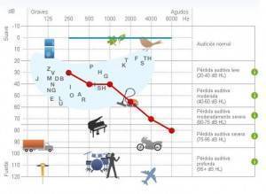 audiometria1